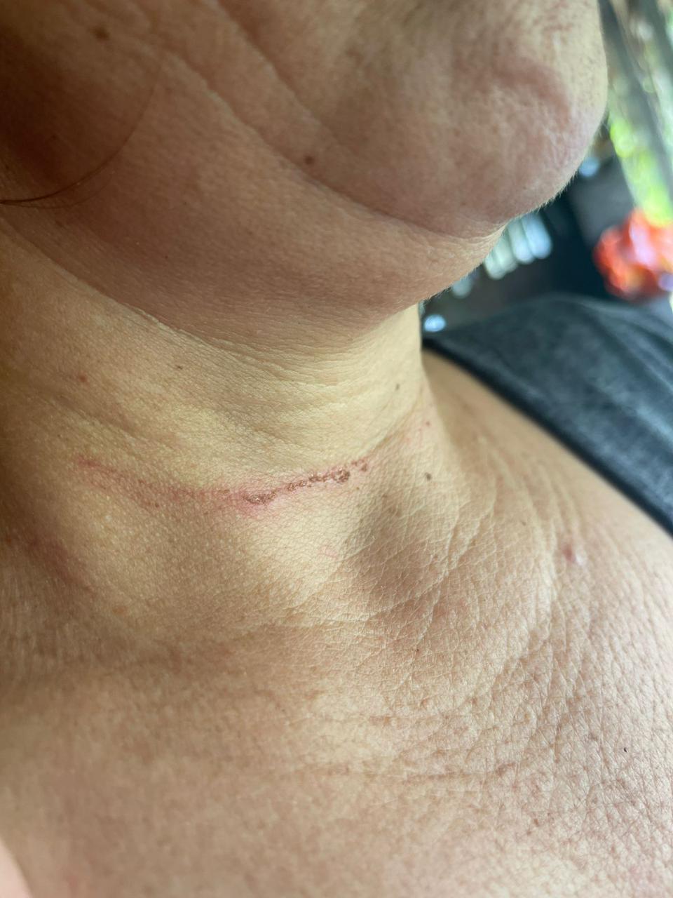 A vítima sofreu várias agressões, mas a PMAC chegou a tempo. Foto: cedida.